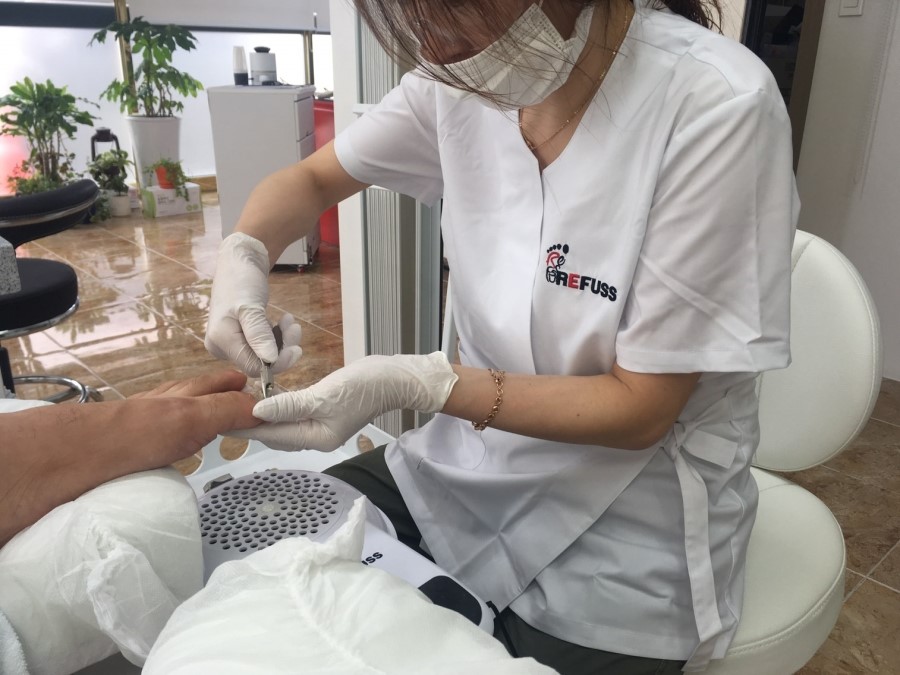 레푸스네일 이미지