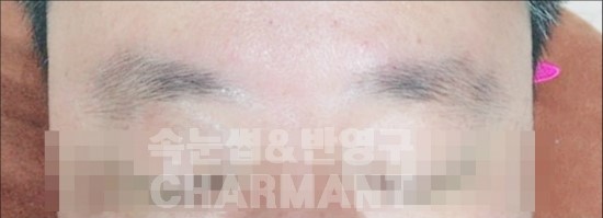 뷰티샤르망 이미지