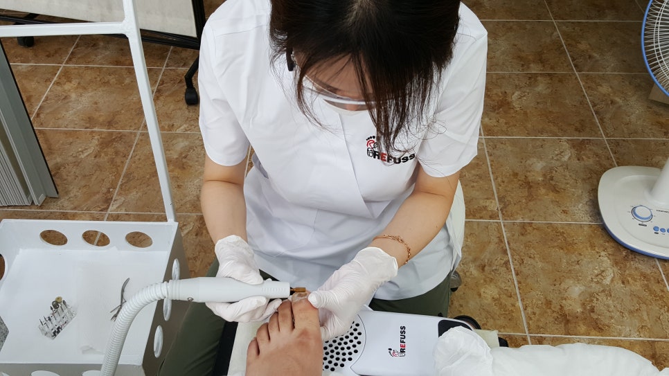 레푸스네일 이미지