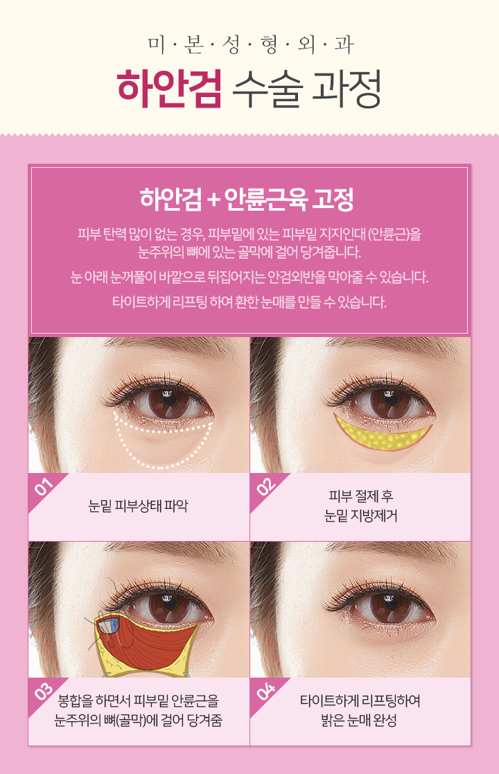미본 이미지