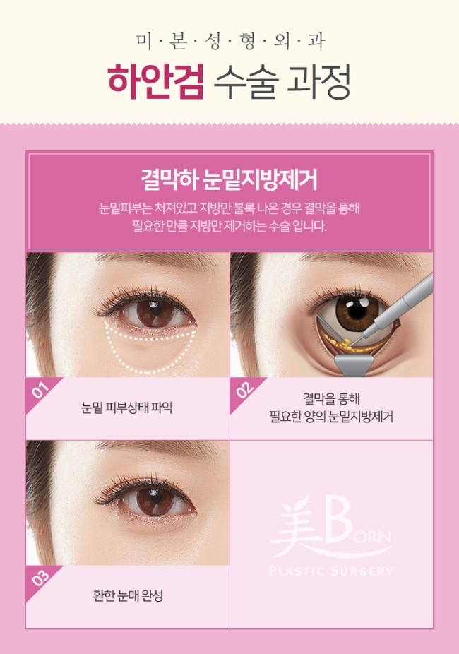미본 이미지
