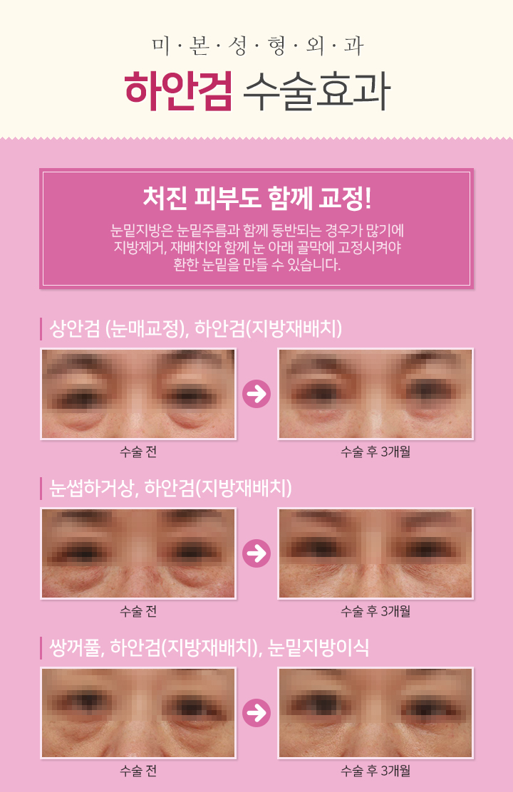 미본 이미지