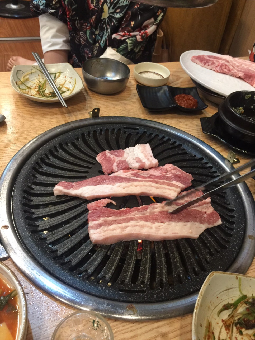 서울플란트치과 이미지