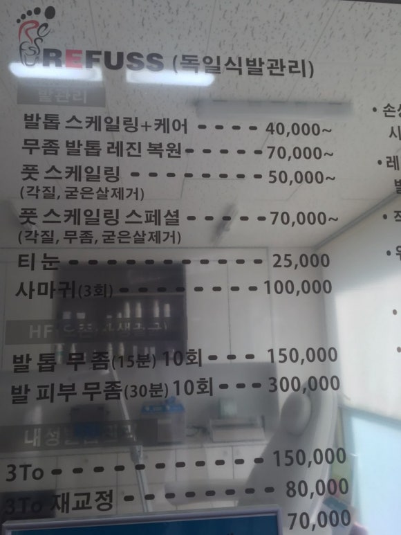 레푸스네일 이미지