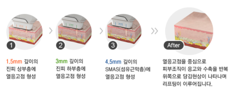 김영숙피부과 이미지