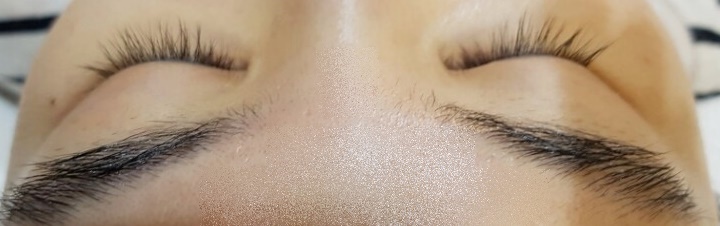 순에스테틱 이미지