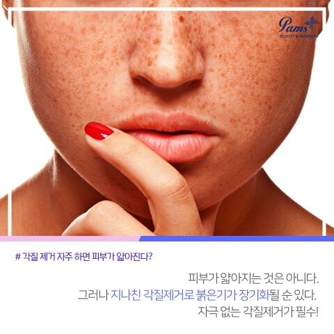 팜스테라 이미지