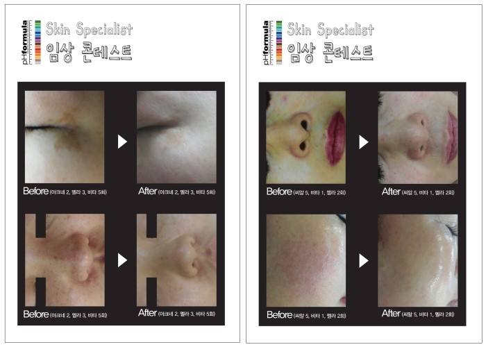 기노코스메틱 이미지