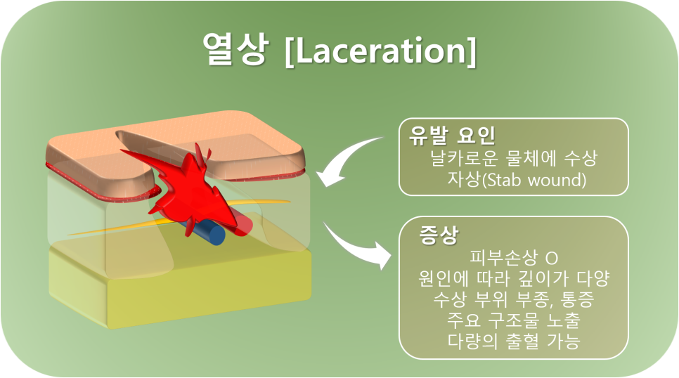 피부상처의 종류 (멍, 혈종, 찰과상, 열상) : 네이버 블로그