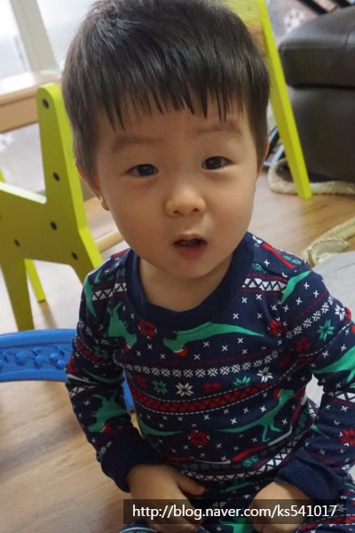애기피부1호 이미지