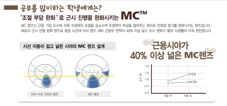 엠씨렌즈 이미지