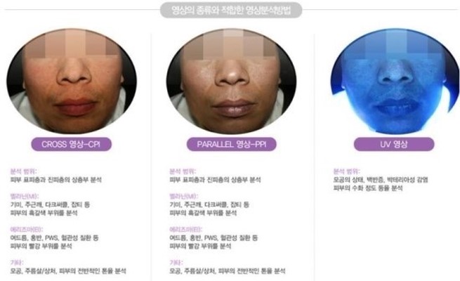 애플피부샵 이미지