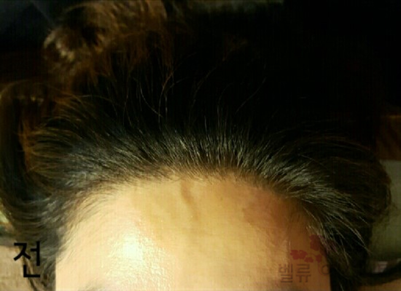 벨류헤어 이미지