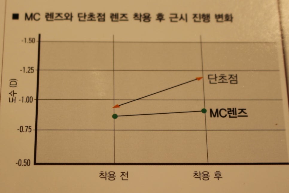 엠씨렌즈 이미지