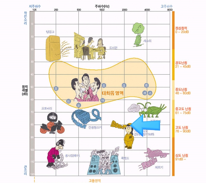 메디컬 보청기 이미지