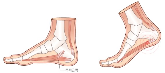 강남보성한의원 이미지