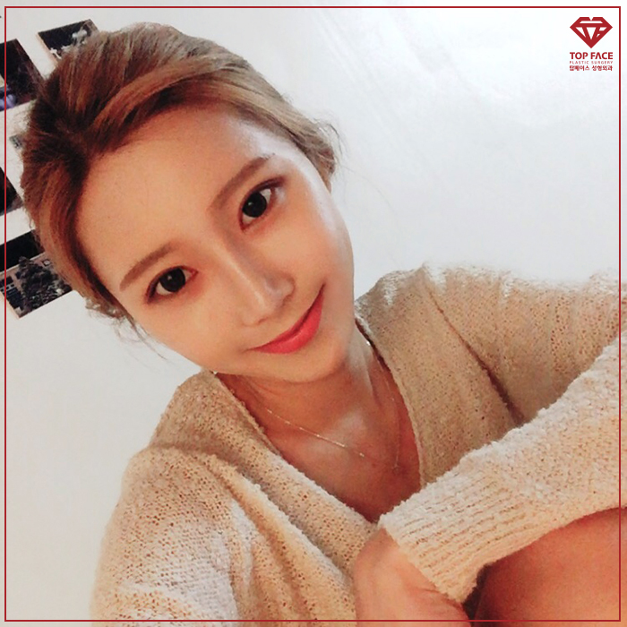 엣지성형외과 이미지