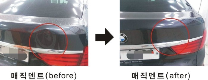 매직덴트 이미지