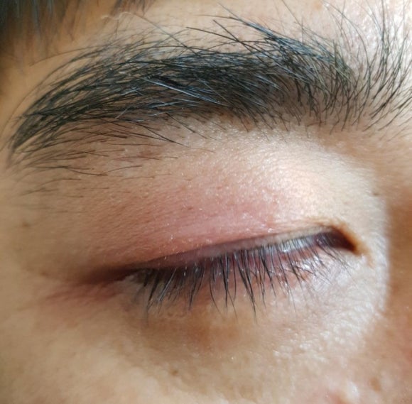 강안과의원 이미지