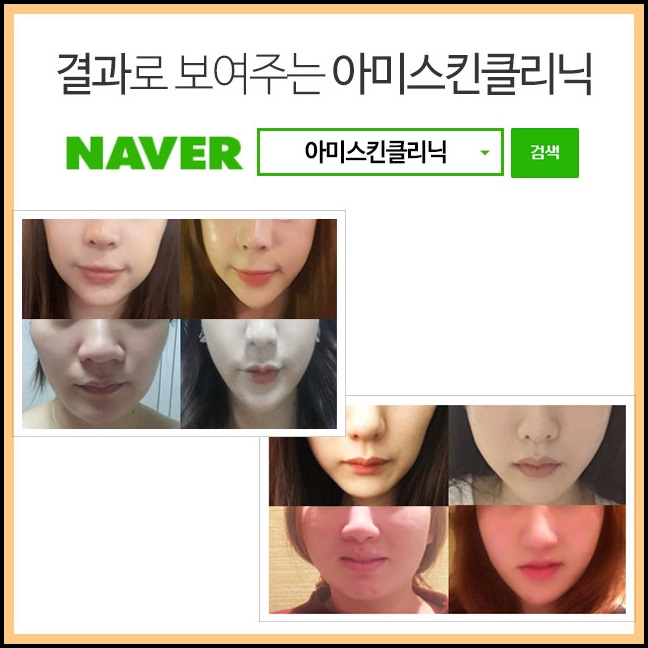 스킨클리닉 이미지