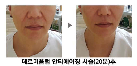 The 예쁜 피부 이미지