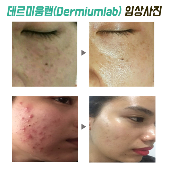 The 예쁜 피부 이미지