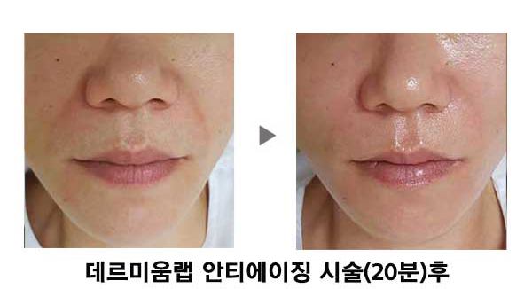 황실피부 이미지