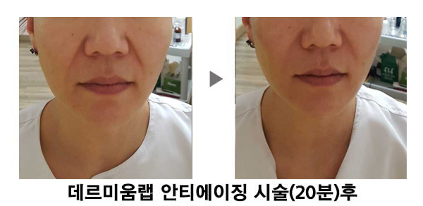 황실피부 이미지