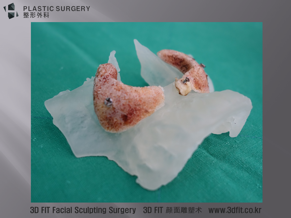 측면에서 보시면, 그 두께가 대략 10mm 가까이 되는 것을 확인 할 수 있습니다.