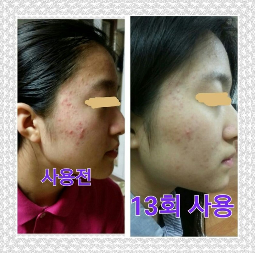 떼즈블랑 이미지