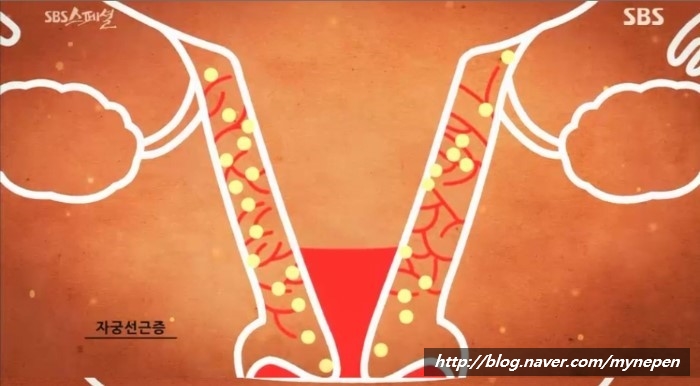 통증N바디테라피 이미지