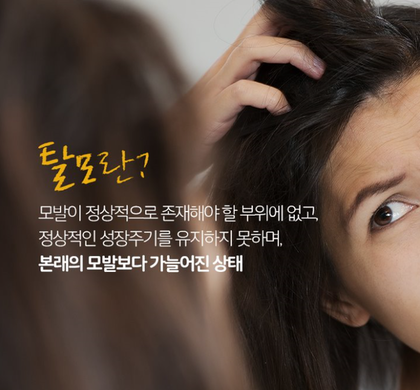 퀸즈헤나 두피 이미지