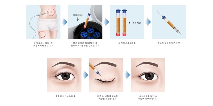 가인비뇨기과 이미지
