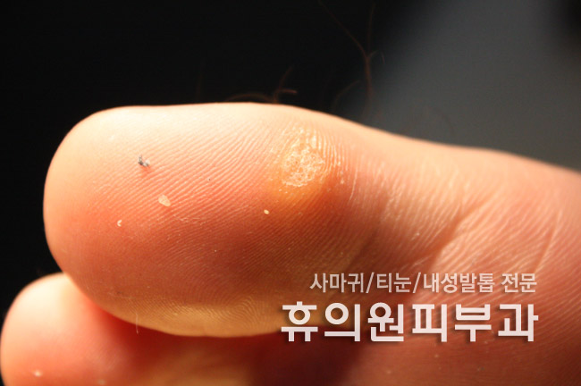 휴의원 이미지