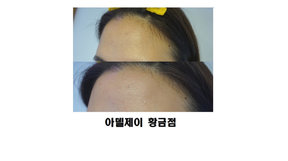 헤어아델샵 이미지