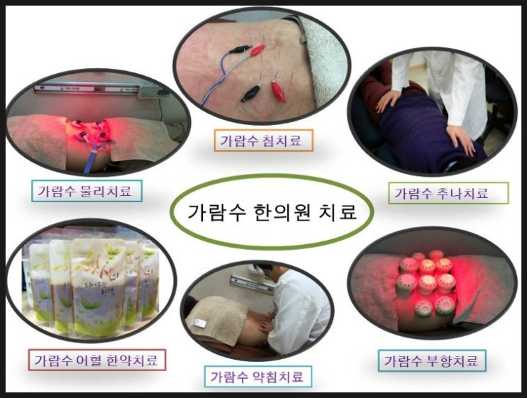 금릉PC 이미지