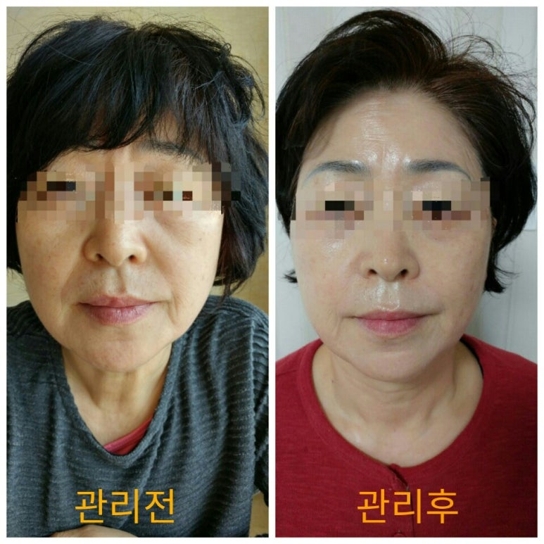 순에스테틱 이미지