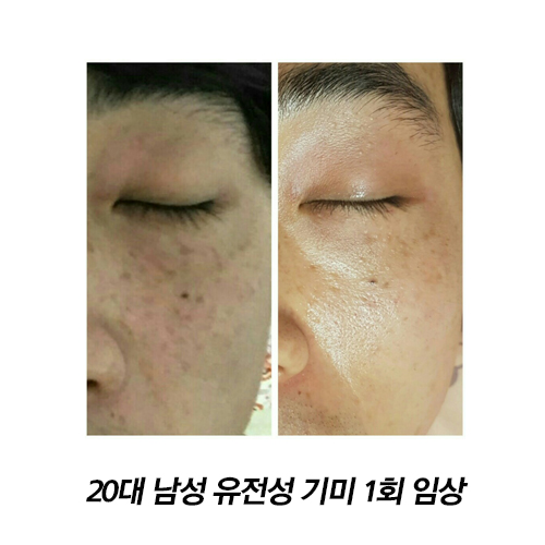 순에스테틱 이미지