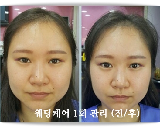 정수옥헤어&예얼두피 이미지