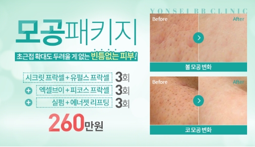 비비네트워크 이미지
