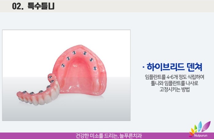 늘푸른치과 이미지