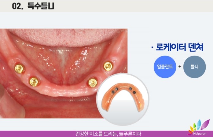 늘푸른치과 이미지