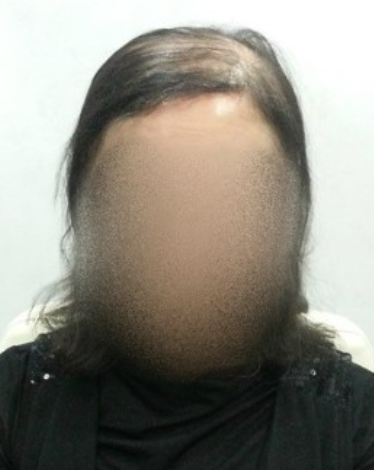 루아헤어&가발 이미지