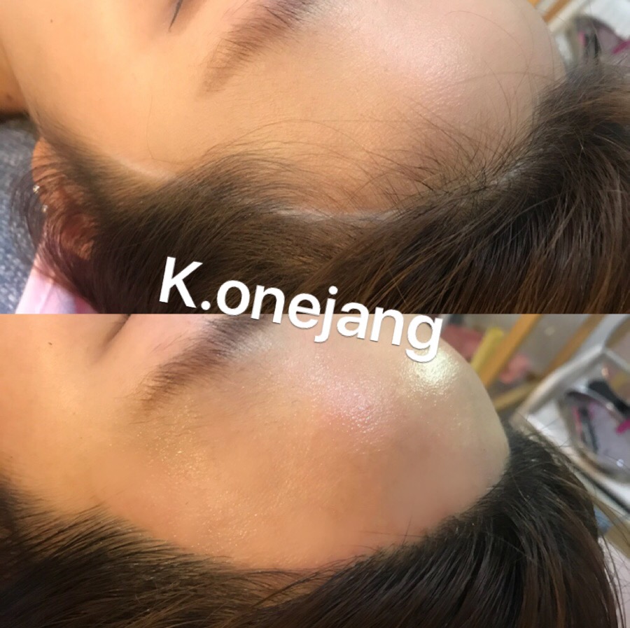 권헤어라인 이미지
