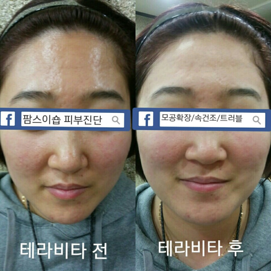 팜스테라 이미지