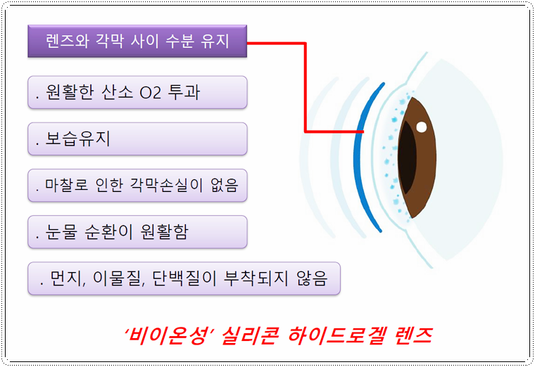 디클린 이미지