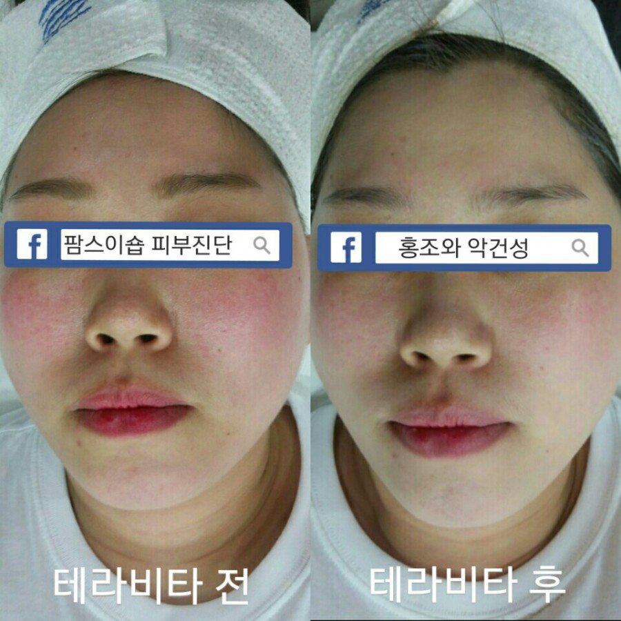 팜스테라 이미지