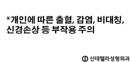 신데렐라성형외과의원 이미지