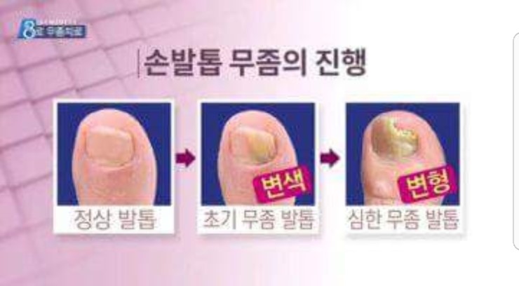 장고 인터네셔널 이미지