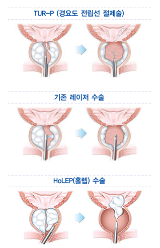 방비뇨기과의원 이미지